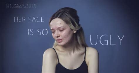 My Pale Skin S Powerful Video Shames The Internet Bullies Metro News