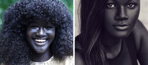 teen bullied for her extremely dark skin color becomes a model and takes the internet by storm