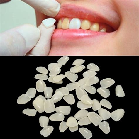 xpcs dental ultra thin whitening porcelain teeth medical veneers