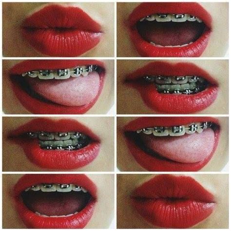 labios rojos braces colors cute braces braces smile