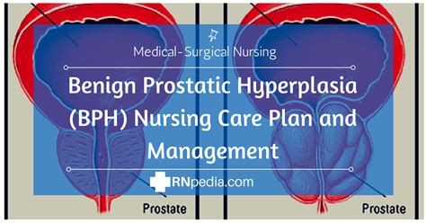 Benign Prostatic Hypertrophy Nursing Care Plan And Management