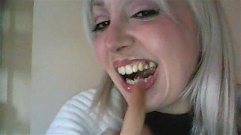 very ugly teeth denti orribili