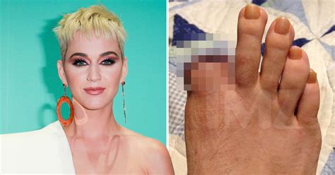 Katy Perry Sued By Stagehand Who Lost Toe After Accident Backstage On