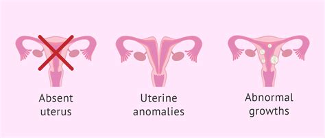 uterine diseases  anomalies