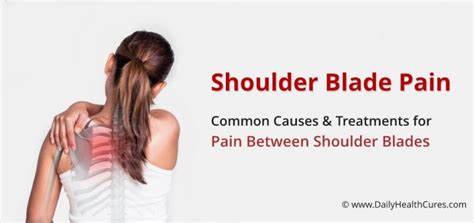 shoulder blade pain     home treatments