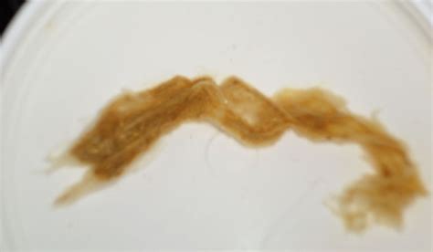id this parasite fluke or tape at parasites support forum alt med with image embedded