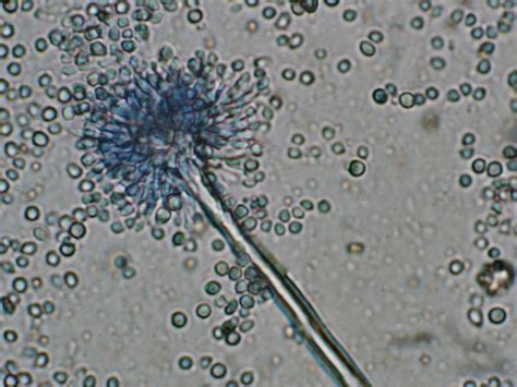 aspergillus fungi pinterest microbiology  lab tech