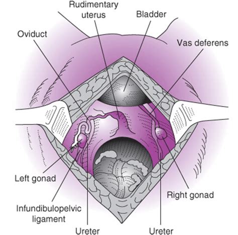 Genetic Disorders And Sex Chromosome Abnormalities Current