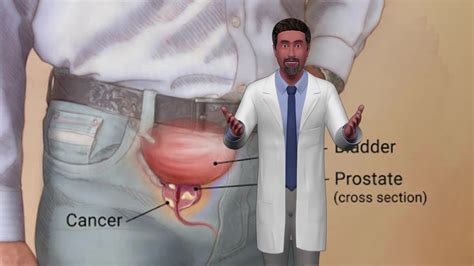 Prostate Health Men S Health Men S Health Tips Malehealthclinic