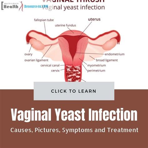 pin on yeast infection and period