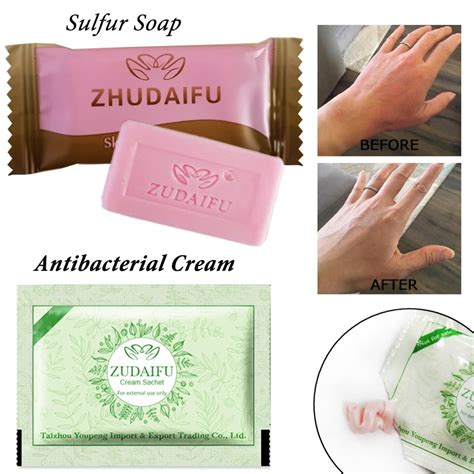 pc zudaifu sulfur soap add pc zudaifu psoriasis cream dermatitis eczematoid eczema ointment