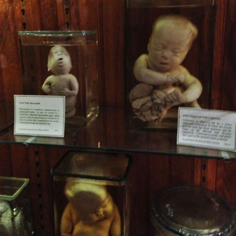 A Collection Of Fetuses And Stillbirths In Jars That Did