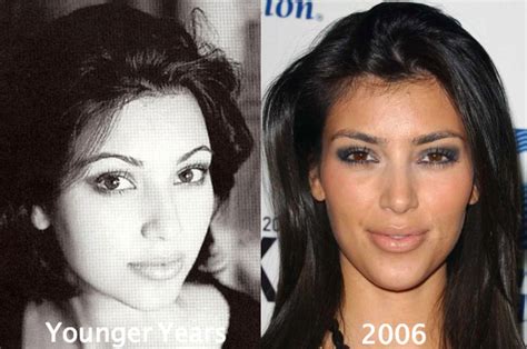 kim kardashian before plastic surgery butt and breast implants
