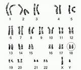 Karyotype Chromosome Chromosomes Between Sex Determine Do Many Pair Pairs Each Genetics Structure 23rd Autosomes Deletion 1p36 Person Look Disease sketch template