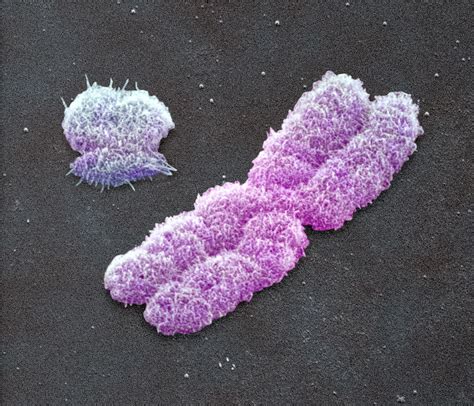 male sex chromosomes sem photograph by power and syred