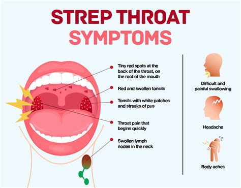 sore throat strep symptoms treating infection  amino company