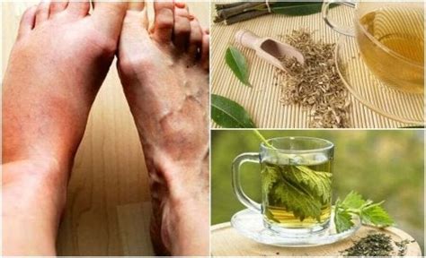 six herbal teas to lower uric acid levels step to health