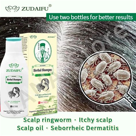 zudaifu hair psoriasis seborrheic skin care treatment dermatitis eczema compound herbal shampoo