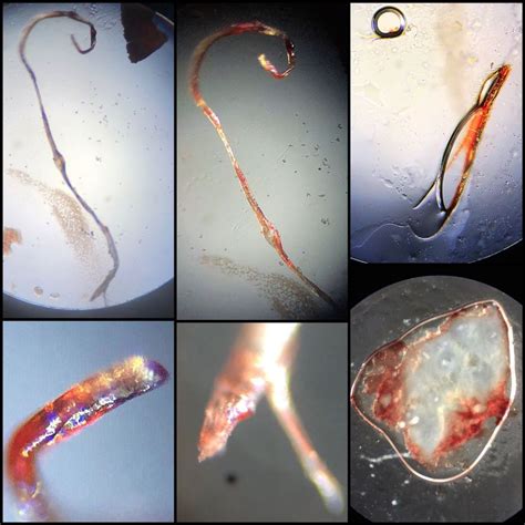 Skin Parasites Worms Demodex Face Tentacles