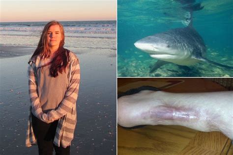 Shark Attack Teenager Saved By Quick Thinking Mum Left Too Traumatised