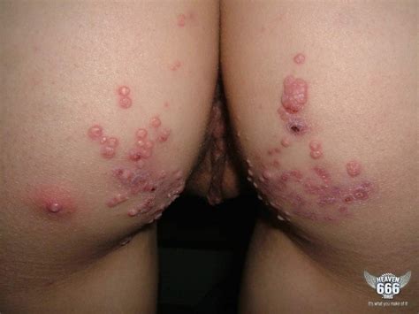 porn stars with diseases pornstar xxx photos