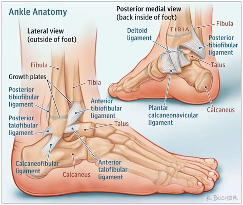 ankle sprains  youth  patient page discusses   treat ankle