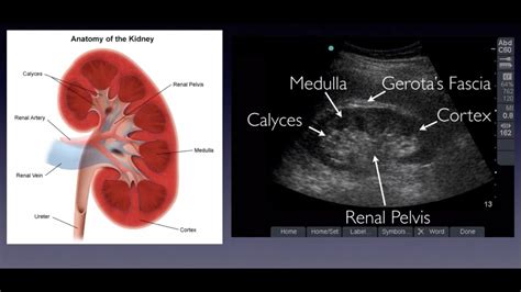 introduction  renal ultrasound youtube