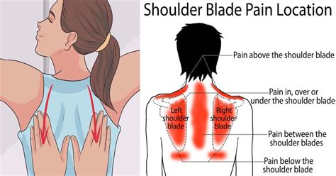 pain  shoulder blades cancer