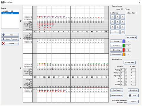 dental  perio charts