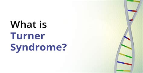 what is turner syndrome symptoms and causes birla fertility and ivf