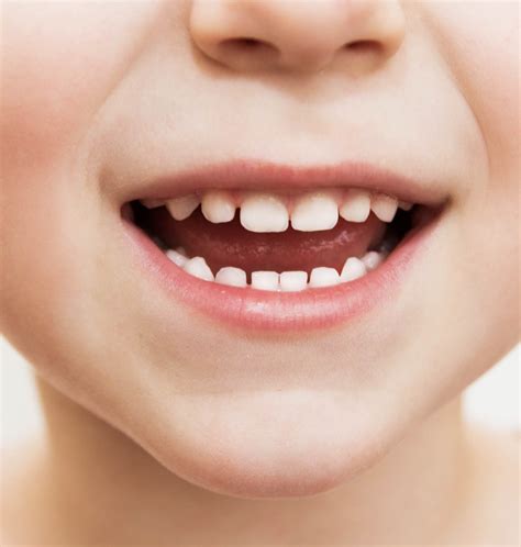 primary teeth frisco mini molars frisco pediatric dentist