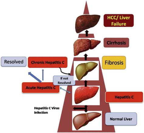 Stages Of Liver Damage This Figure Shows How Normal Healthy Liver
