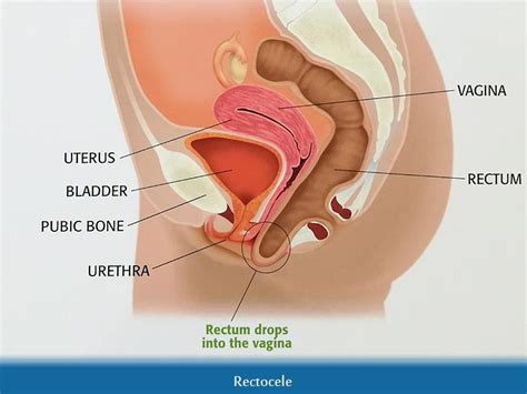urethral orifice into the anus sex photo