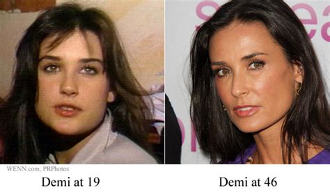 Demi Moore Plastic Surgery Before And After Breast