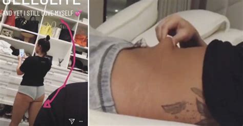 demi lovato posted pictures of her stretch marks extra