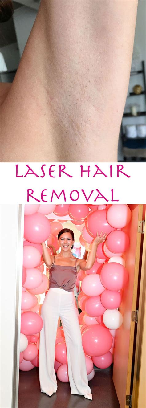 Laser Hair Removal All You Need To Know About The Hair