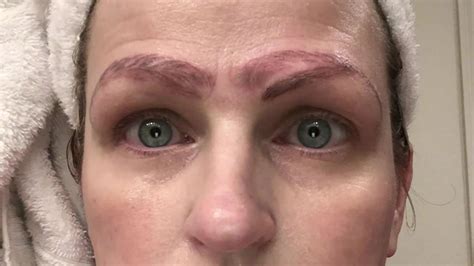 woman suffers eyebrow disaster in microblading gone wrong