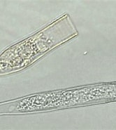 Afbeeldingsresultaten voor "Helicostomella subulata". Grootte: 166 x 184. Bron: protist.i.hosei.ac.jp