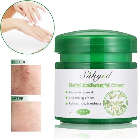 natural herbal cream itch relief creamchinese herbal antibacterial skin creams amazoncouk