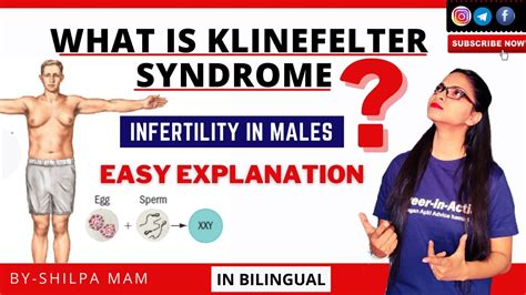 What Is Klinefelter Syndrome Chromosomal Disorder Symptoms And