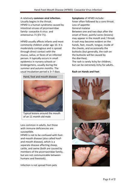 Hand Foot Mouth Disease Coxsackie Virus Infection