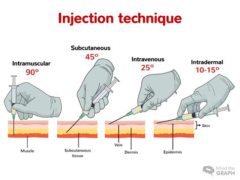 injection techniques food health pitribe