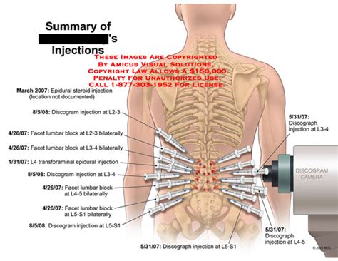images   lumbar spine diagram        spine picture