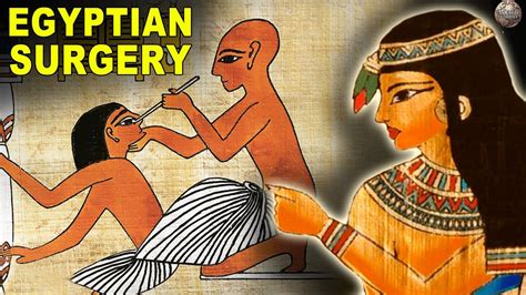 What Surgery Was Like In Ancient Egypt