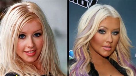 49 celebrities before and after plastic surgery doovi