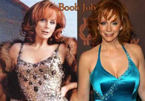 Reba Mcentire Boob Job Porn Photo