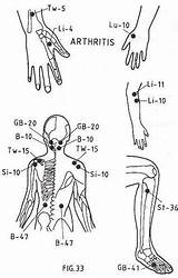 Points Acupressure Acupuncture Arthritis Therapy Treatment Massage Hand Chart Reflexology Adrenal Point Labor Therapies Natural sketch template