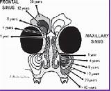 Sinuses Maxillary sketch template