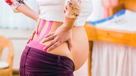 Sciatica During Pregnancy What To Expect
