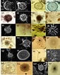 Afbeeldingsresultaten voor "acanthosphaera Pinchuda". Grootte: 85 x 106. Bron: www.researchgate.net